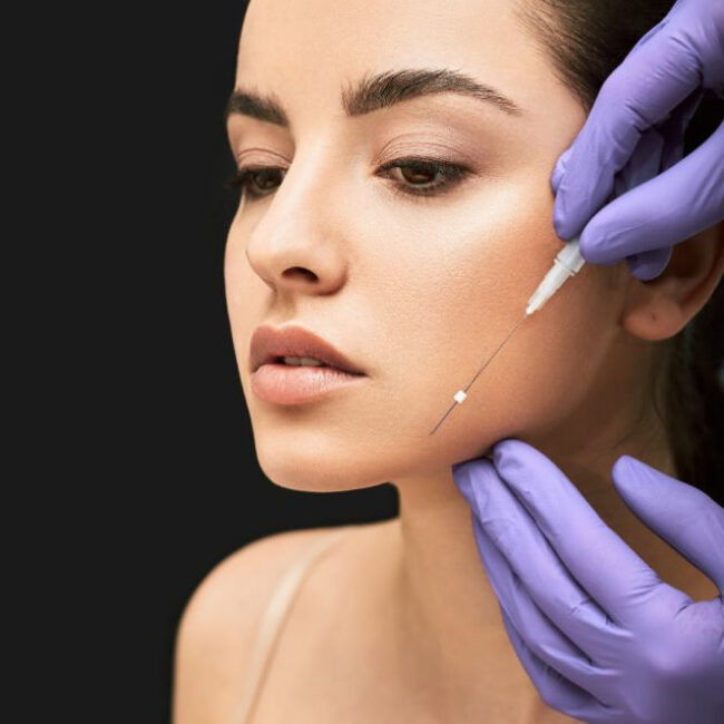 hilos tensores faciales medicina estética