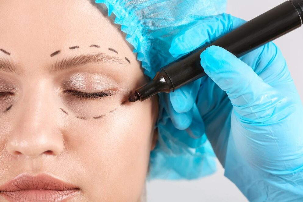 blefaroplastia superior en valencia